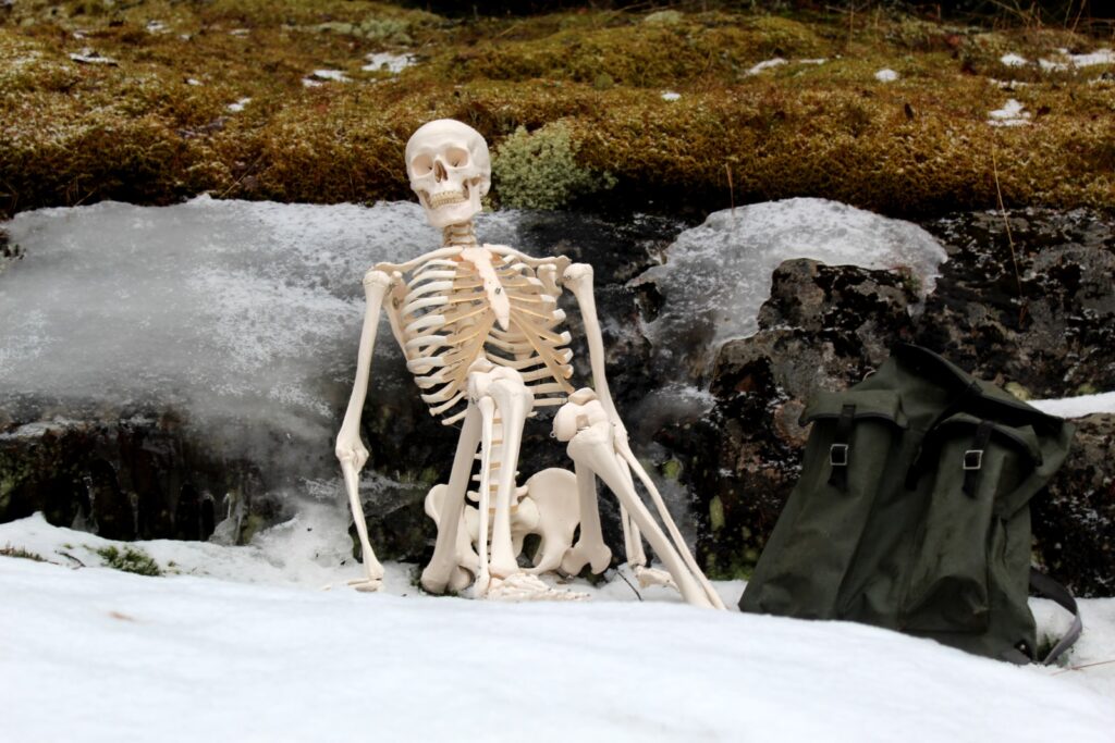 skeleton sitting outside showing bad alignment of hips